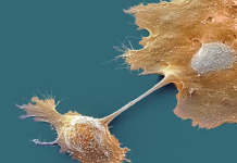 Breakthrough drug nearly doubles survival with advanced pancreatic cancer – an oncologist explains how daraxonrasib overcame an ‘undruggable’ disease